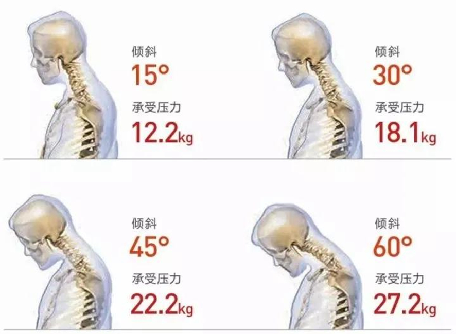 激光切割機助力金屬電腦支架，解決辦公族“低頭病”